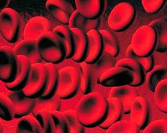 Accumulo di corpi chetonici nel sangue nel diabete